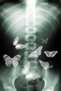 X-ray butterflies in my stomach