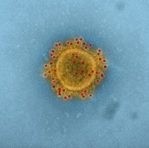 Virus